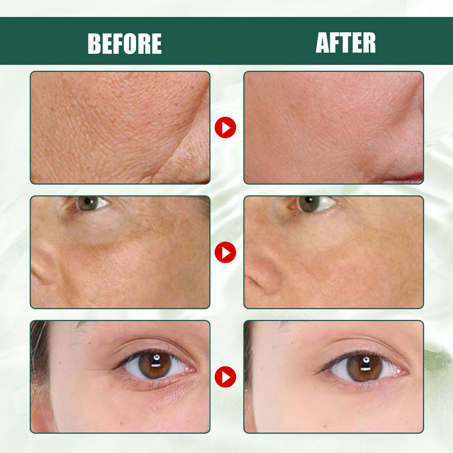 Intensive Anti-wrinkle Fade Fine Lines And Dark Circles Adjust Skin Tone Tighten And Moisturize Skin Care